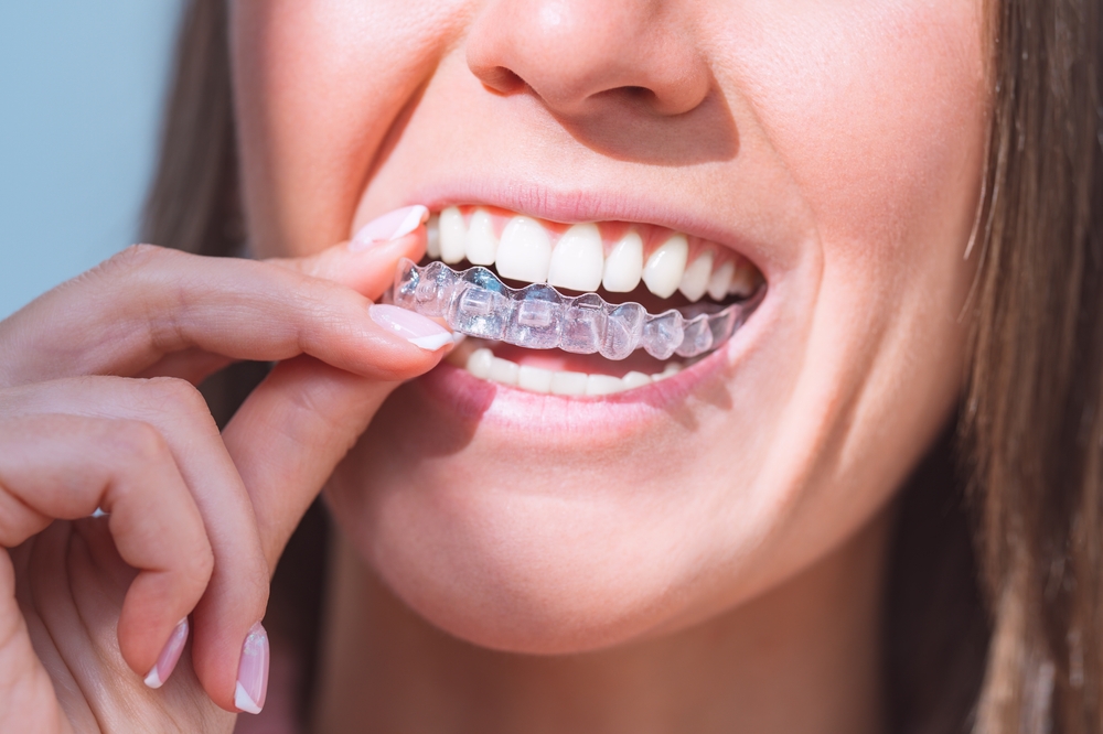 Woman,With,Orthodontics & Invisalign Orthodontics & Invisalign at Seven Dental Clinic in Calk Farm, NW3